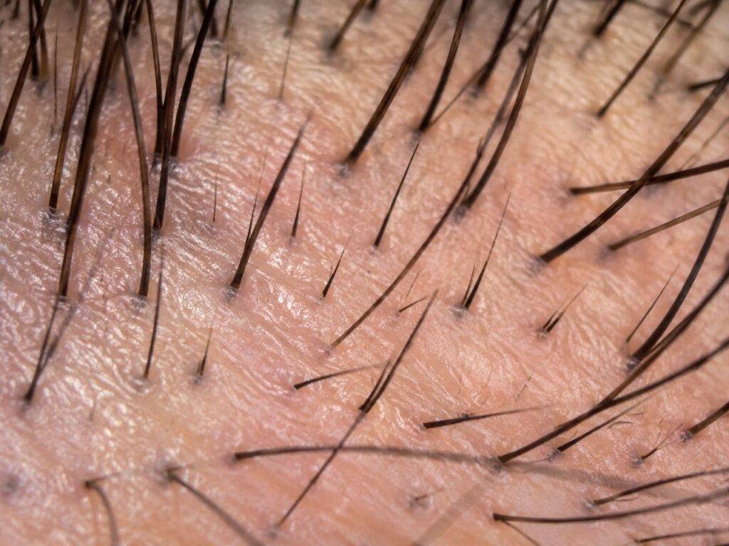 How Nutrition Supports the Hair Growth Cycle